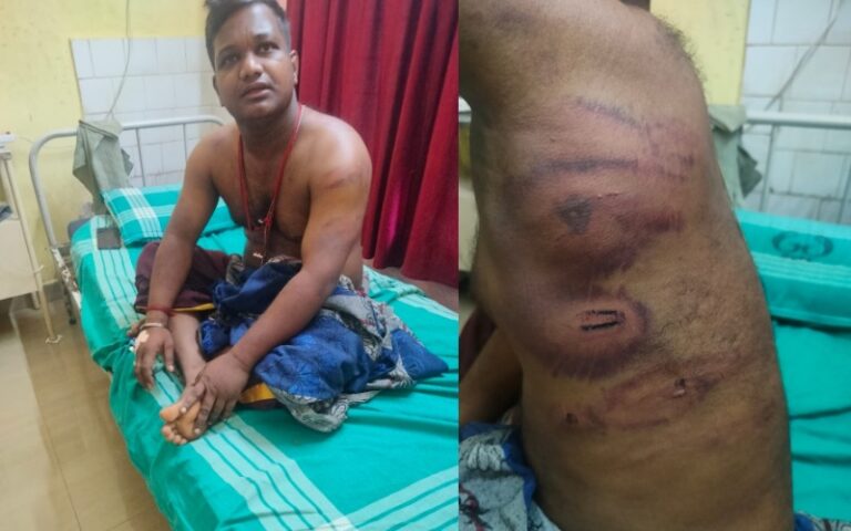 ಯಕ್ಷಗಾನ ಕಲಾವಿದನಿಗೆ ಅಮಾನುಷ ಹಲ್ಲೆ: ಖಾಲಿ ಬಾಂಡ್ ಪೇಪರ್‌ಗೆ ಬಲಾತ್ಕಾರದಿಂದ ಸಹಿ