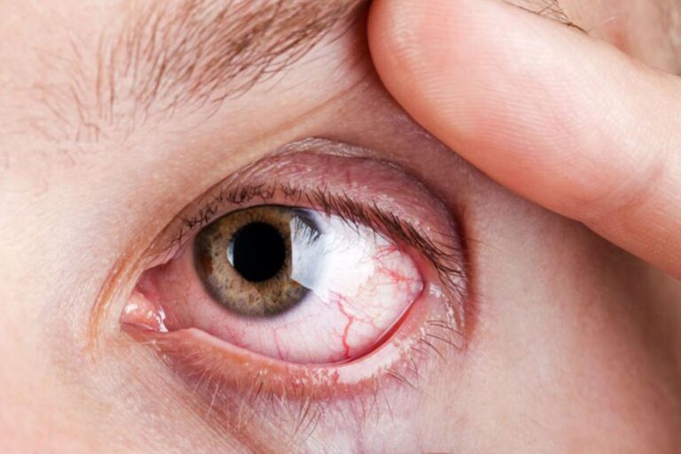 ಮಧುಮೇಹ: ದೇಹದ ಅಂಗಗಳ ಮೇಲೆ ಪರಿಣಾಮ ಬೀರಬಹುದಾದ ಸಮಸ್ಯೆ