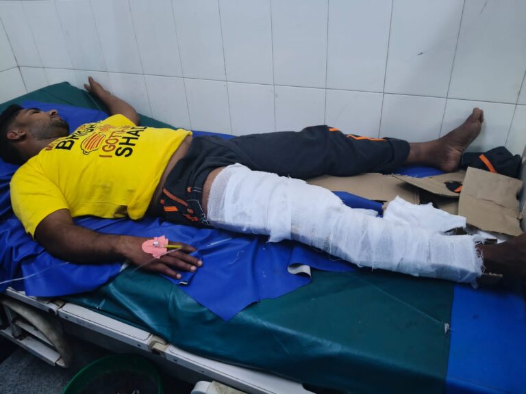 ರೌಡಿಶೀಟರ್ ಕಣುಮನ ಕೊಲೆ ಪ್ರಕರಣ: ಪಂಚನಾಮೆ ಮಾಡಿಸುವ ವೇಳೆ ತಪ್ಪಿಸಿಕೊಳ್ಳಲು ಯತ್ನ- ಕೊಲೆ ಆರೋಪಿ ಚಾವಳಿ ಸಂತೋಷ್ ಕಾಲಿಗೆ ಗುಂಡೇಟು