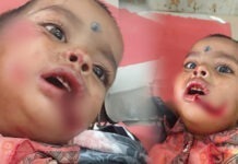 ಬೆಳಗಾವಿ: ಬೀದಿನಾಯಿ ಹಾವಳಿ ಹೆಚ್ಚಳ