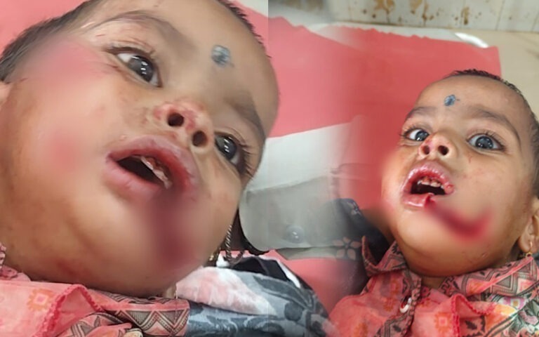 ಬೆಳಗಾವಿ: ಬೀದಿನಾಯಿ ಹಾವಳಿ ಹೆಚ್ಚಳ ಬೆಳಗಾವಿ: ಬೀದಿನಾಯಿ ಹಾವಳಿ ಹೆಚ್ಚಳ