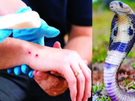 ಹಾವಿನ ವಿಷ ಪತ್ತೆಗೆ ಕನ್ನಡಿಗನಿಂದ ಸೋವಿ ಕಿಟ್!