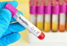 ʻಹಿಮೋಫಿಲಿಯಾ’ ಸಂತ್ರಸ್ತರಿಗೆ ರಾಜ್ಯ ಸರ್ಕಾರ ಗುಡ್ನ್ಯೂಸ್