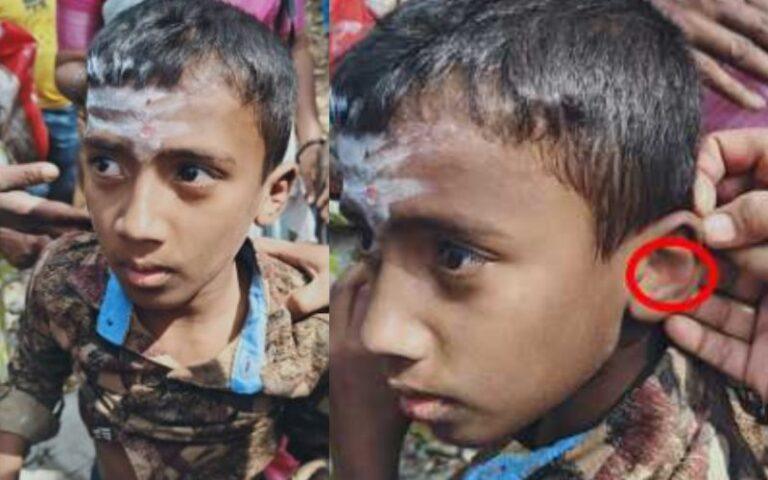 ಪಾದಯಾತ್ರಿಗಳ ಮೇಲೆ ಚಿರತೆ ದಾಳಿ: ಬಾಲಕನಿಗೆ ಗಾಯ