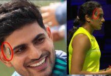 ನೆಟ್ಸ್ನಲ್ಲಿ ಗಿಲ್ ಹಣೆಗೆ ಕಟ್ಟಿದ್ದ ವಿಚಿತ್ರ ಡಿವೈಸ್ ಏನು?! ಕಣ್ಣಿಗೆ ಕಟ್ಟುವಂತಿದೆ ಜೊಮ್ಯಾಟೊ ಸಿಇಒ ಹೊಸ ಅವಿಷ್ಕಾರ!